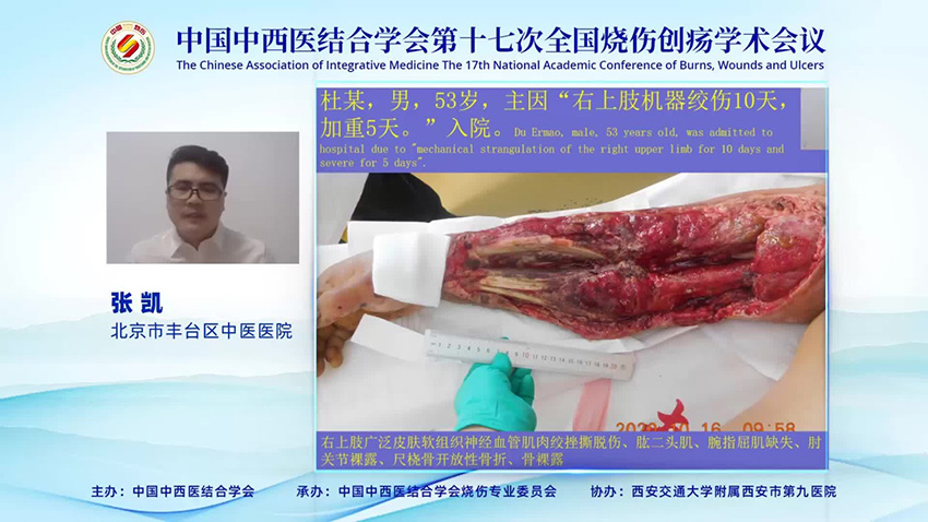 GA黄金甲(中国)最新官方网站