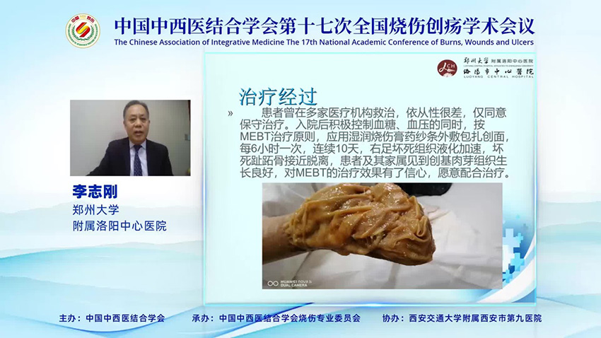 GA黄金甲(中国)最新官方网站