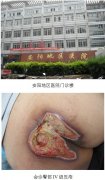 1-13051613410YC-lp
